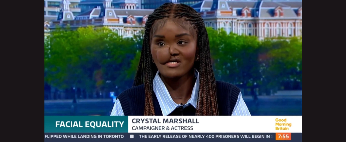 markettiers web image_grey